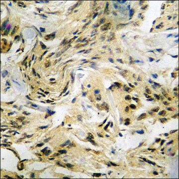 Anti-phospho-AFX (pSer197) antibody produced in rabbit affinity isolated antibody