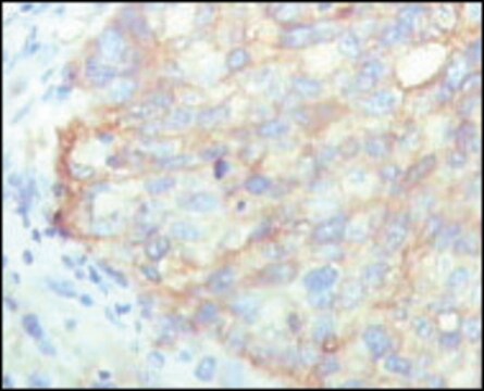 Monoclonal Anti-KARS antibody produced in mouse clone 8G12C1, ascites fluid