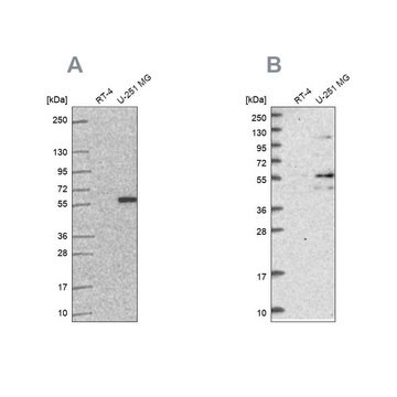 Anti-ACSBG1 antibody produced in rabbit Prestige Antibodies&#174; Powered by Atlas Antibodies, affinity isolated antibody