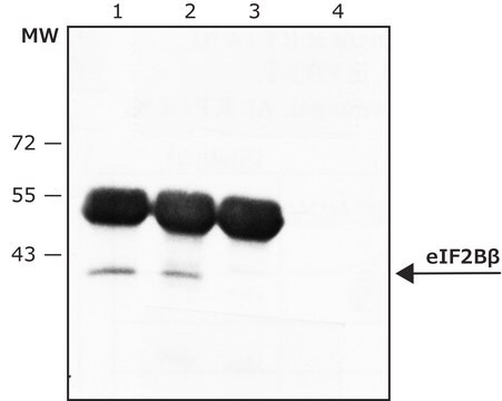 Anti-eIF2B&#946; (C-terminal) antibody produced in rabbit ~1.0&#160;mg/mL, affinity isolated antibody, buffered aqueous solution