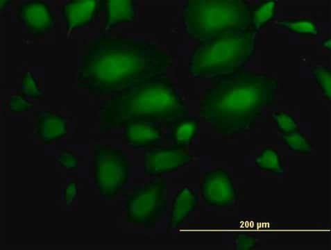 Anti-ANKS1A antibody produced in mouse purified immunoglobulin, buffered aqueous solution