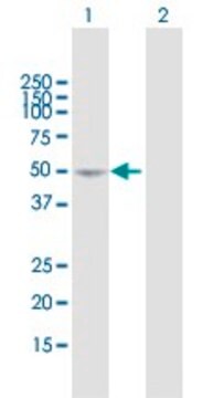 Anti-SEMA3D antibody produced in mouse purified immunoglobulin, buffered aqueous solution