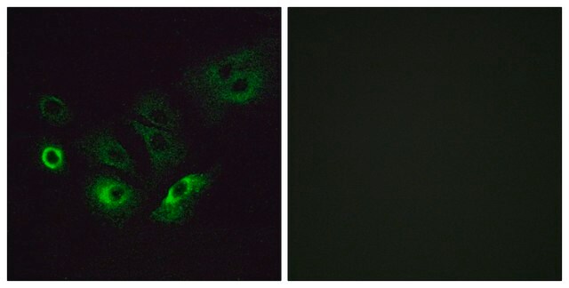 Anti-OR4Q3 antibody produced in rabbit affinity isolated antibody