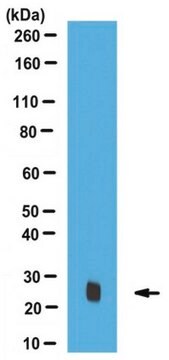 Anti-Rab32 Antibody serum, from rabbit