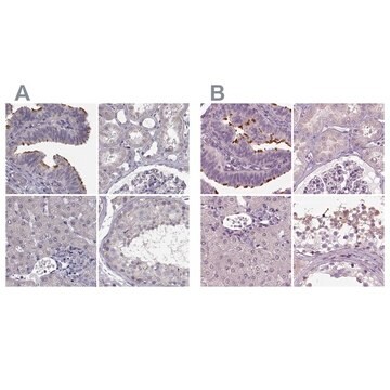 Anti-ARMC3 antibody produced in rabbit Prestige Antibodies&#174; Powered by Atlas Antibodies, affinity isolated antibody, buffered aqueous glycerol solution