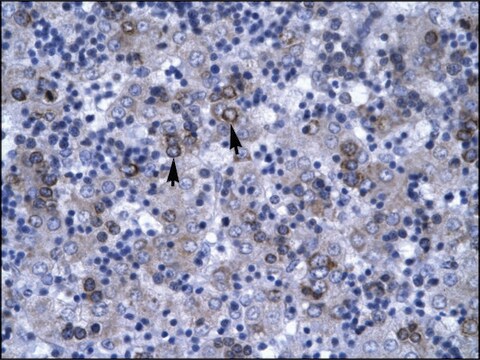 Anti-DBP (AB2) antibody produced in rabbit affinity isolated antibody