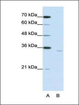 Anti-CPEB2 antibody produced in rabbit IgG fraction of antiserum