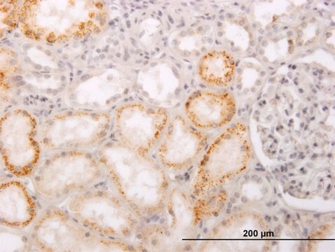 Monoclonal Anti-PHACS antibody produced in mouse clone 1D2, purified immunoglobulin, buffered aqueous solution