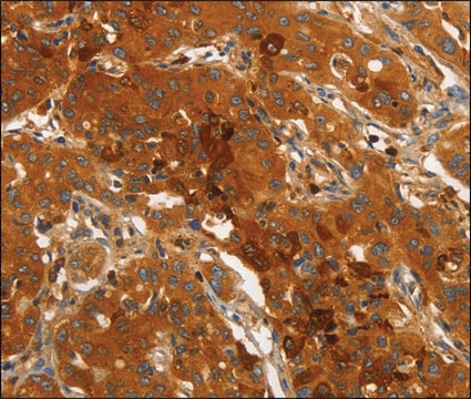 Anti-ORM2 antibody produced in rabbit affinity isolated antibody