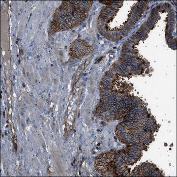 Anti-HEPACAM antibody produced in rabbit Prestige Antibodies&#174; Powered by Atlas Antibodies, affinity isolated antibody, buffered aqueous glycerol solution