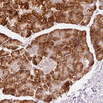 Anti-RPL10A antibody produced in rabbit Prestige Antibodies&#174; Powered by Atlas Antibodies, affinity isolated antibody, buffered aqueous glycerol solution