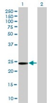 Anti-GSTT2 antibody produced in mouse purified immunoglobulin, buffered aqueous solution