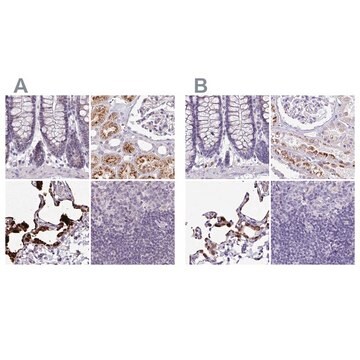 Anti-NAPSA antibody produced in rabbit Prestige Antibodies&#174; Powered by Atlas Antibodies, affinity isolated antibody, buffered aqueous glycerol solution