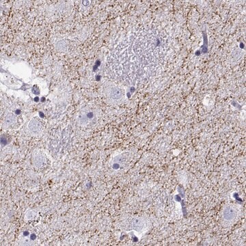 Anti-SLC18A2 antibody produced in rabbit Prestige Antibodies&#174; Powered by Atlas Antibodies, affinity isolated antibody