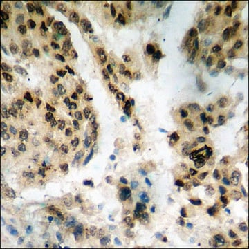 Anti-phospho-Histone H2A.X (pSer139) antibody produced in rabbit affinity isolated antibody