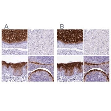 Anti-A2ML1 antibody produced in rabbit Prestige Antibodies&#174; Powered by Atlas Antibodies, affinity isolated antibody, buffered aqueous glycerol solution