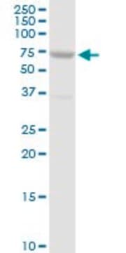 Anti-SLC27A5 antibody produced in rabbit purified immunoglobulin, buffered aqueous solution