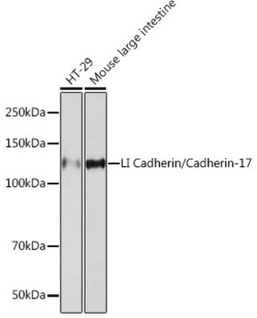 Anti-LI Cadherin/Cadherin-17 Antibody, clone 9X2S3, Rabbit Monoclonal