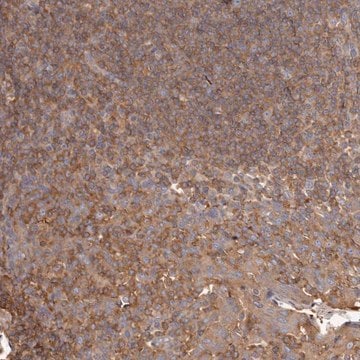 Anti-CAP1 antibody produced in rabbit Prestige Antibodies&#174; Powered by Atlas Antibodies, affinity isolated antibody, buffered aqueous glycerol solution