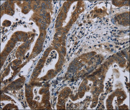 Anti-BRINP1 antibody produced in rabbit affinity isolated antibody