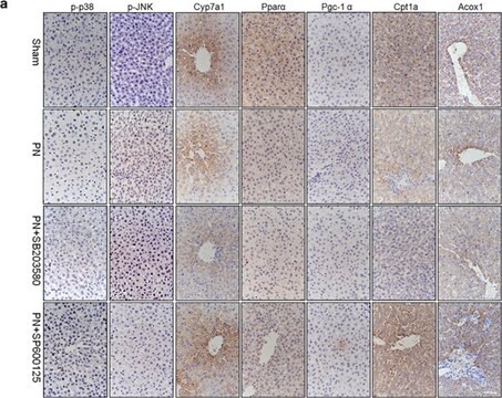 Anticuerpo anti-Cyp7a1, clon 15B9.1 clone 15B9.1, from mouse