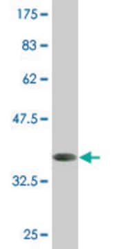 Monoclonal Anti-HOXD1 antibody produced in mouse clone 4F4, purified immunoglobulin, buffered aqueous solution