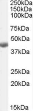 Anti-BHMT antibody produced in goat affinity isolated antibody, buffered aqueous solution