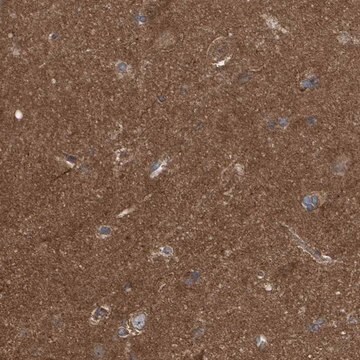 Anti-LRSAM1 antibody produced in rabbit Prestige Antibodies&#174; Powered by Atlas Antibodies, affinity isolated antibody, buffered aqueous glycerol solution, Ab2