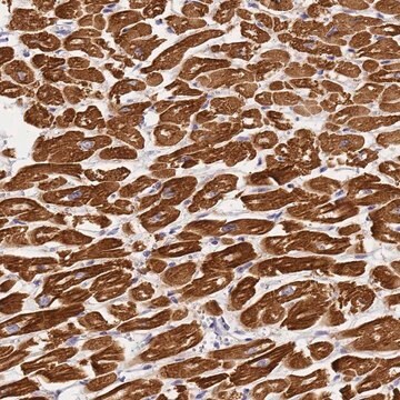 Anti-MYL2 antibody produced in rabbit Prestige Antibodies&#174; Powered by Atlas Antibodies, affinity isolated antibody, buffered aqueous glycerol solution