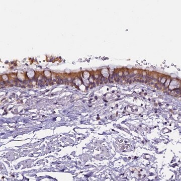 Anti-CEP170 antibody produced in rabbit Prestige Antibodies&#174; Powered by Atlas Antibodies, affinity isolated antibody, buffered aqueous glycerol solution