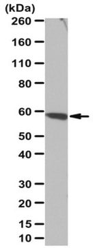 Anti-mSin1 Antibody from rabbit, purified by affinity chromatography