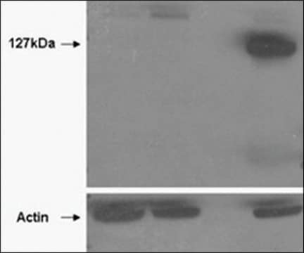 Anti-TNKS2 antibody produced in goat affinity isolated antibody, buffered aqueous solution