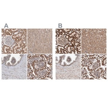 Anti-MRPL45 antibody produced in rabbit Prestige Antibodies&#174; Powered by Atlas Antibodies, affinity isolated antibody, buffered aqueous glycerol solution, Ab2