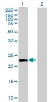 Anti-ATG12 antibody produced in mouse purified immunoglobulin, buffered aqueous solution