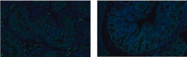 Anti-SOX17 from rabbit, purified by affinity chromatography