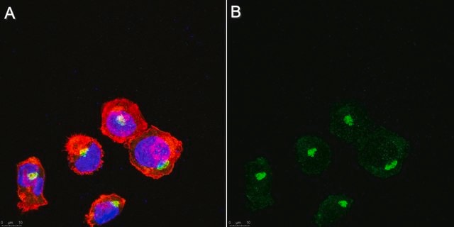 Anti-PI4-Kinase &#946;