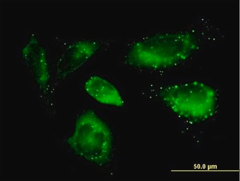 Anti-SQSTM1 antibody produced in mouse purified immunoglobulin, buffered aqueous solution