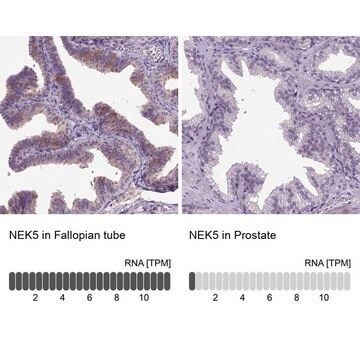 Anti-NEK5 antibody produced in rabbit Prestige Antibodies&#174; Powered by Atlas Antibodies, affinity isolated antibody, buffered aqueous glycerol solution