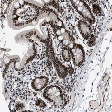 Anti-URB1 antibody produced in rabbit Prestige Antibodies&#174; Powered by Atlas Antibodies, affinity isolated antibody, buffered aqueous glycerol solution