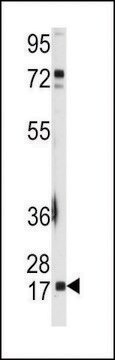 ANTI-UBC9 (UBE2I)(N-TERMINAL) antibody produced in rabbit IgG fraction of antiserum, buffered aqueous solution