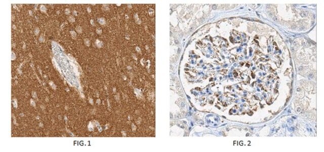 Anticorps anti-alpha-synucléine (a.a.&nbsp;121-125), clone&nbsp;Syn211 (sans ascite) clone Syn211, from mouse