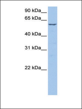 Anti-STK39 (AB1) antibody produced in rabbit affinity isolated antibody