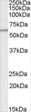 Anti-ATGL/Desnutrin antibody produced in goat affinity isolated antibody, buffered aqueous solution