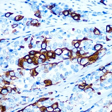 Anti-Cytokeratin 5 (KRT5) Antibody, clone 3P3T9, Rabbit Monoclonal