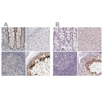 Anti-ACTRT2 antibody produced in rabbit Prestige Antibodies&#174; Powered by Atlas Antibodies, affinity isolated antibody, buffered aqueous glycerol solution