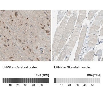 Anti-LHPP antibody produced in rabbit Ab2, Prestige Antibodies&#174; Powered by Atlas Antibodies, affinity isolated antibody, buffered aqueous glycerol solution