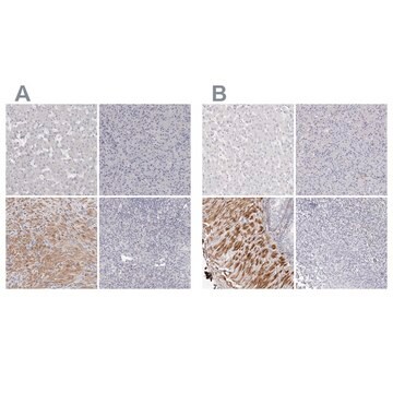 Anti-LMOD1 antibody produced in rabbit Prestige Antibodies&#174; Powered by Atlas Antibodies, affinity isolated antibody, buffered aqueous glycerol solution, ab2