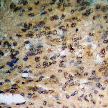 Anti-phospho-PKD1/2/3/PKC mu (pSer738+Ser742) antibody produced in rabbit affinity isolated antibody