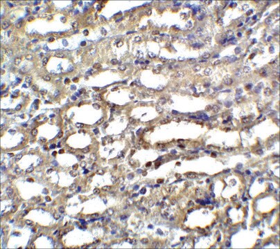 Anti-ICAD antibody produced in rabbit affinity isolated antibody, buffered aqueous solution