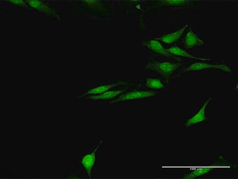 Anti-SNCG antibody produced in rabbit purified immunoglobulin, buffered aqueous solution